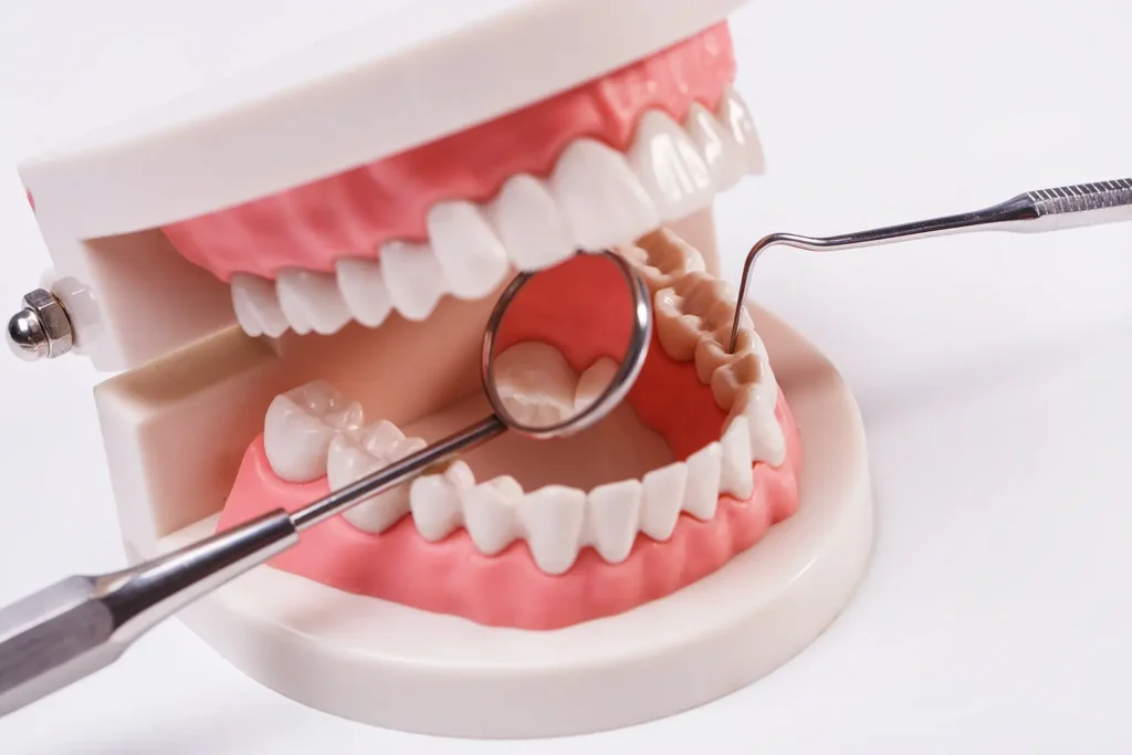 A dental model with tools demonstrating proper oral care techniques, highlighting the importance of maintaining gum health to prevent gum disease.