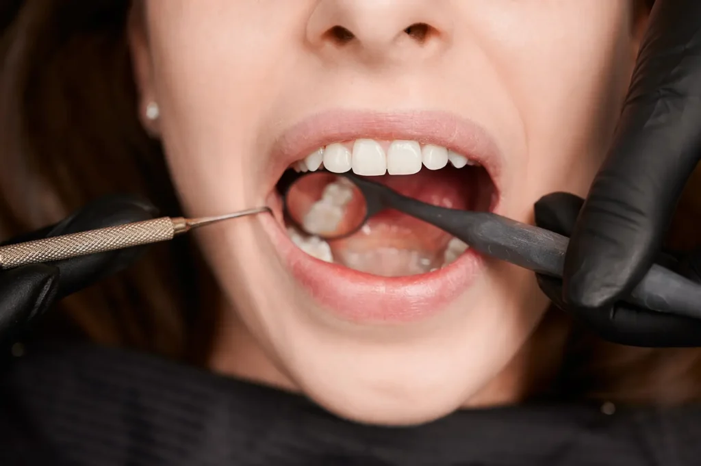 Family Dental Care provides exceptional periodontal care as a woman undergoes a dental examination.